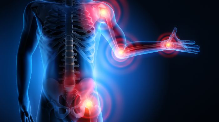 electrotherapy and osteoarthritis essay electrotherapy and osteoarthritis essay